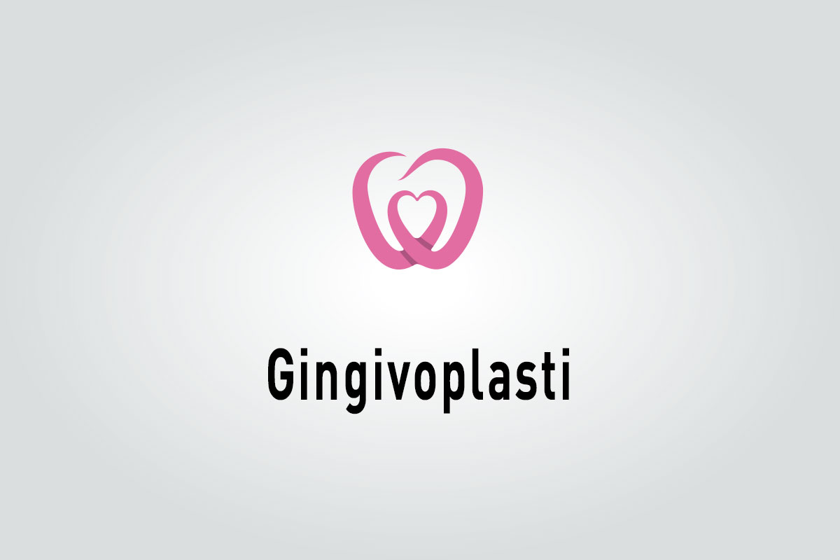 Gingivoplasti